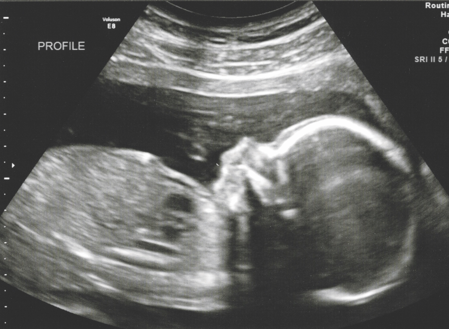 Nolan Baby 19 weeks image 2.jpg